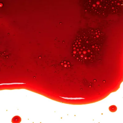 New Blood Type B(A) Discovered, Expanding Human Blood Group Classification