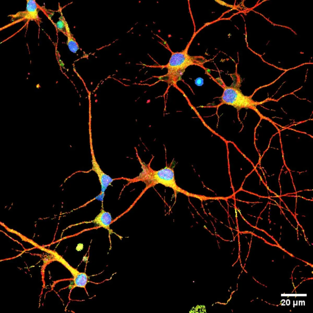 Novel Compound FLAV-27 Targets Gene Control in Alzheimer's Research, Showing Promise in Preclinical Studies