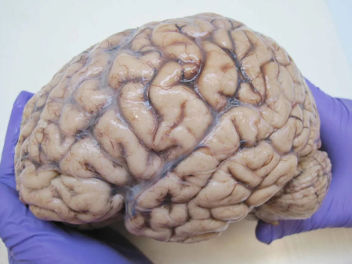 شركة ناشئة تستخدم أدمغة بشرية محفوظة لتطوير الأدوية: جدل علمي وأخلاقي